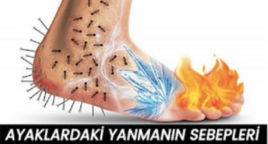 Ayak Yanması Neden Olur? İşte Sebepleri - 4