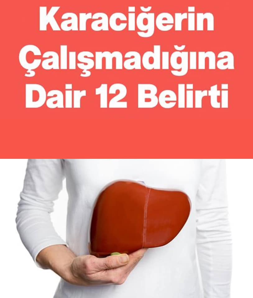 Karaciğerin Çalışmadığına Gösteren 12 Belirti - 1