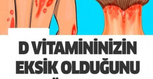 D Vitamini Eksikliğiniz Olduğunu Gösteren 10 Belirgin İşaret